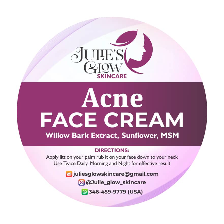 Acne Face Cream