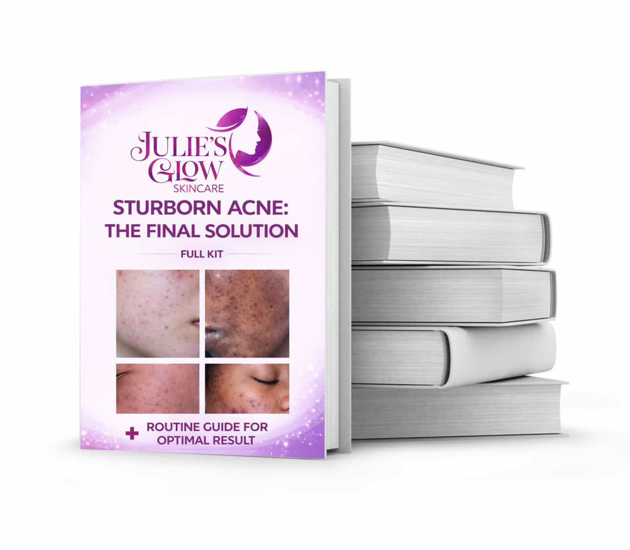 Ebook for stubborn acne and pimples